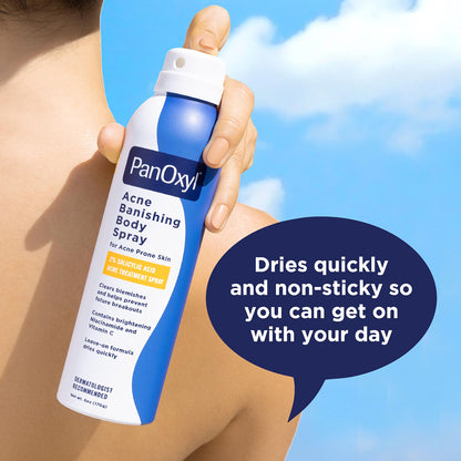 PanOxyl Acne Banishing Body Spray 2% Salicylic Acid 6 oz (170 g)