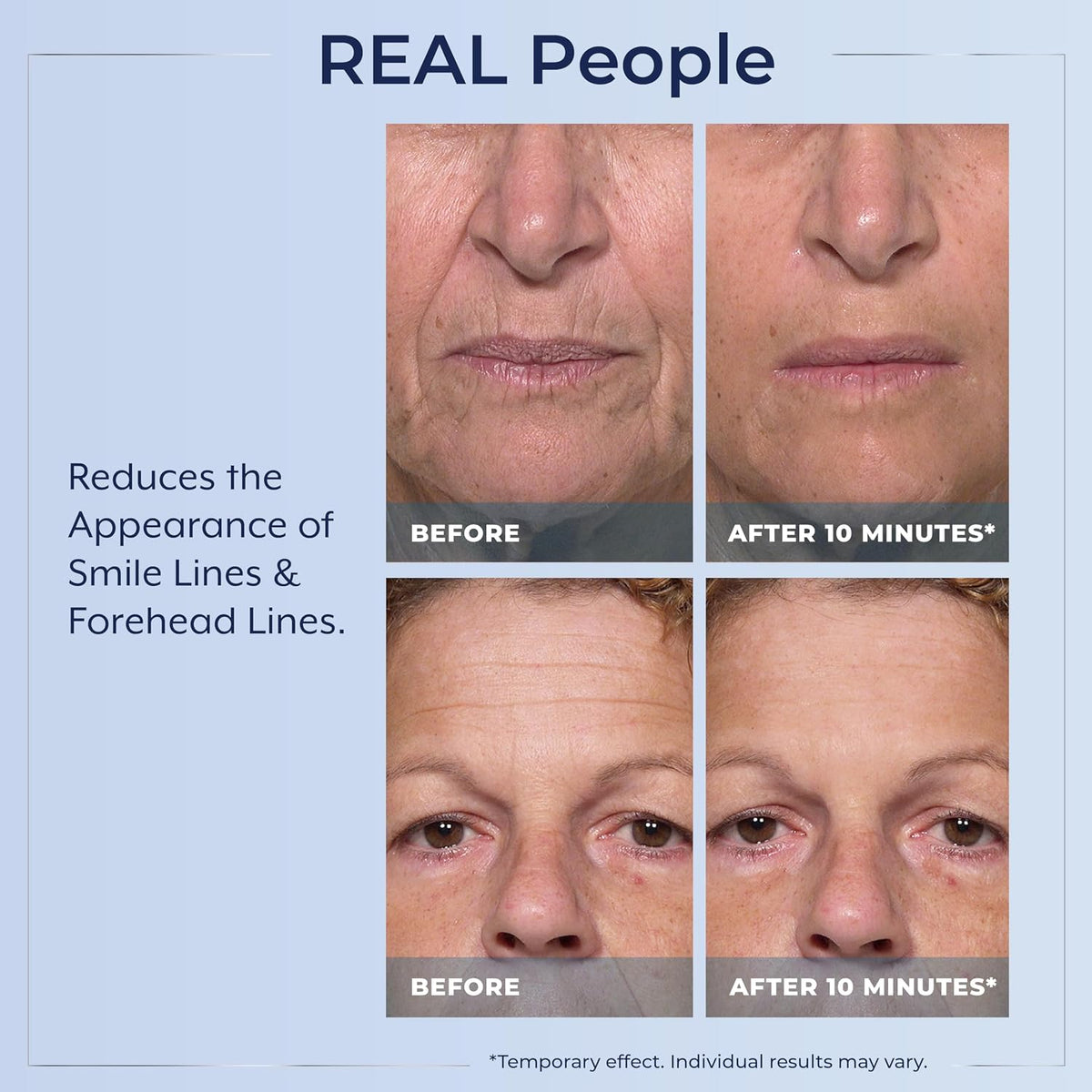 Plexaderm Rapid Reduction Eye Serum with Pump - view 4