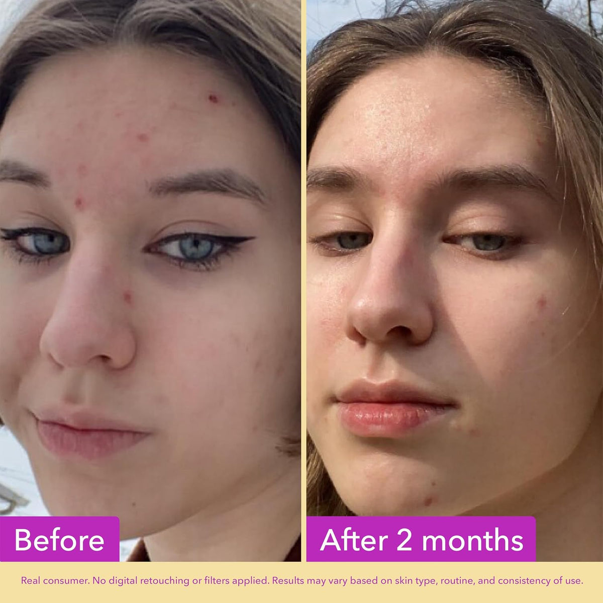 Good Molecules Niacinamide Serum 10% 30 ml - view 3