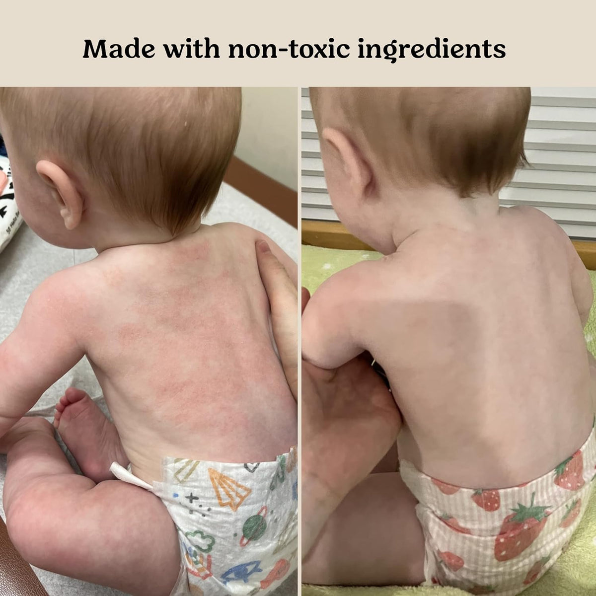 Roe Wellness Baby Cream and Baby Serum Power Pair - view 3