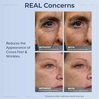 Plexaderm Rapid Reduction Eye Serum with Pump - view 5