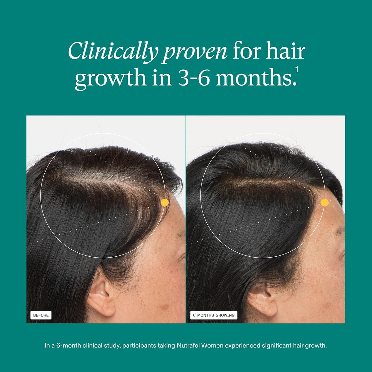 Nutrafol Women Hair Growth Supplement, Ages 18-44, 1-Month Supply - view 6