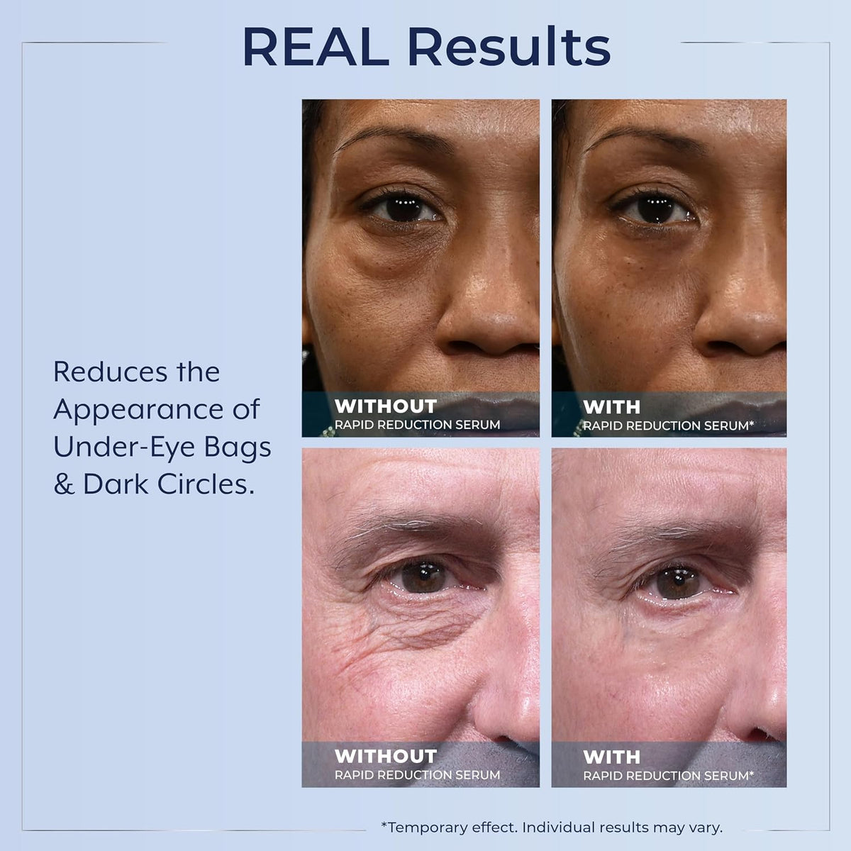 Plexaderm Rapid Reduction Eye Serum with Pump - view 6