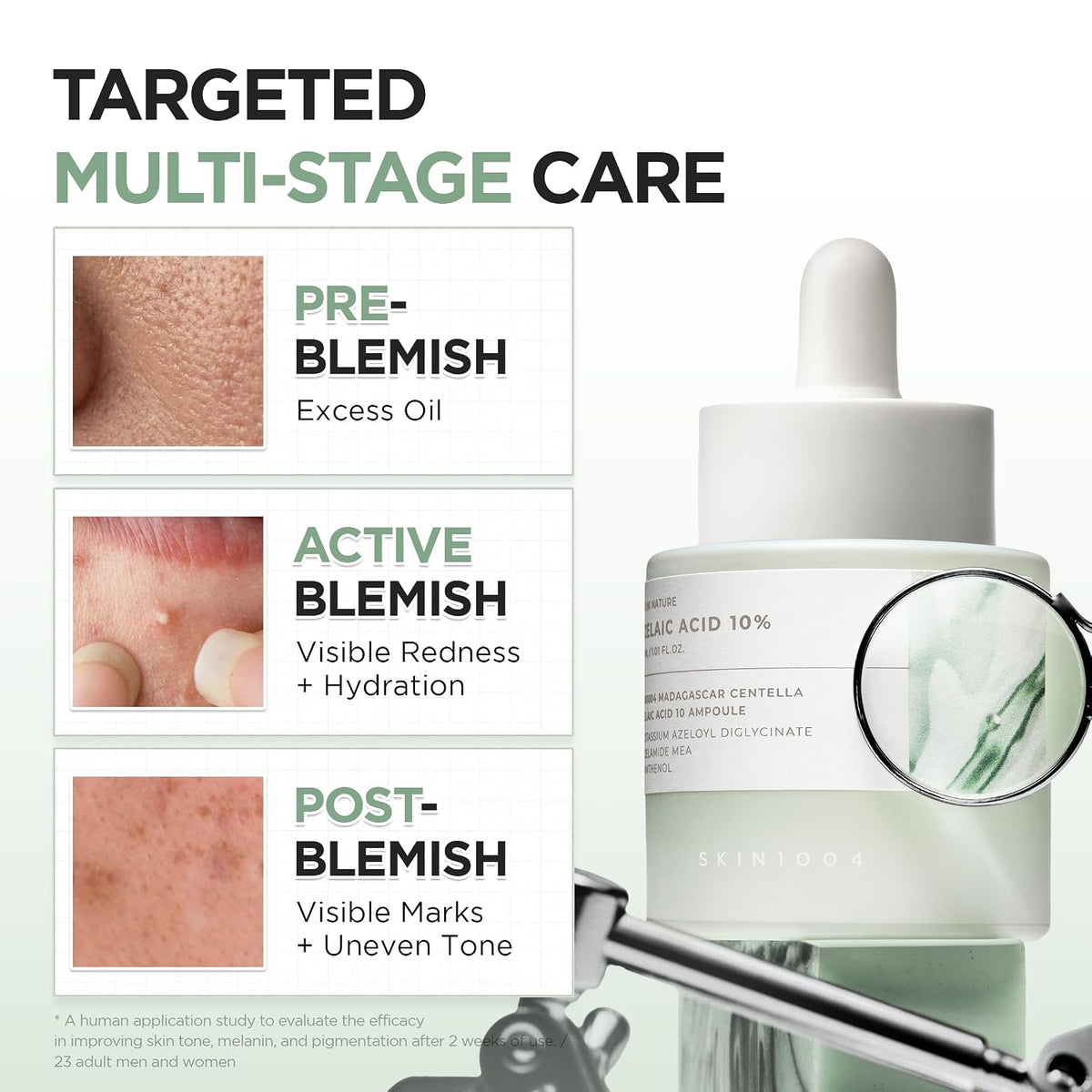 SKIN1004 Azelaic Acid 10% Ampoule, Centella Serum, 1.01 fl oz (30 ml) - view 3