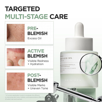 SKIN1004 Azelaic Acid 10% Ampoule, Centella Serum, 1.01 fl oz (30 ml) - view 3