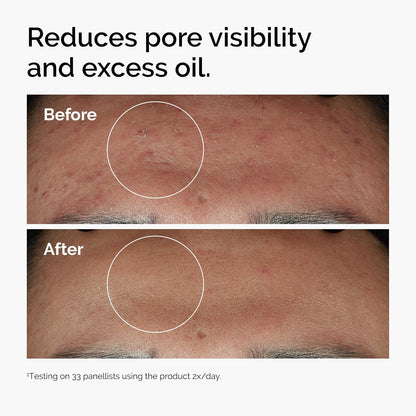 The Ordinary Niacinamide 10% + Zinc 1% Serum 30 ml - view 2