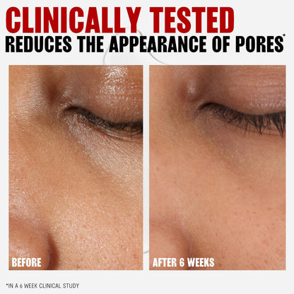 Thayers Coconut Witch Hazel Facial Toner with Aloe Vera 355 ml (12 fl oz) - view 2