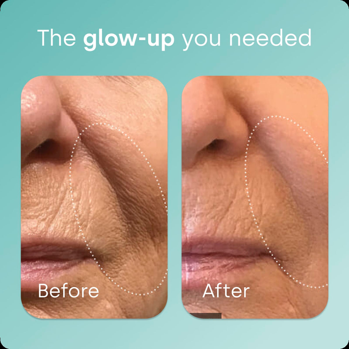 Biosil Advanced Collagen Generator, 0.5 fl oz (15 ml) - view 5