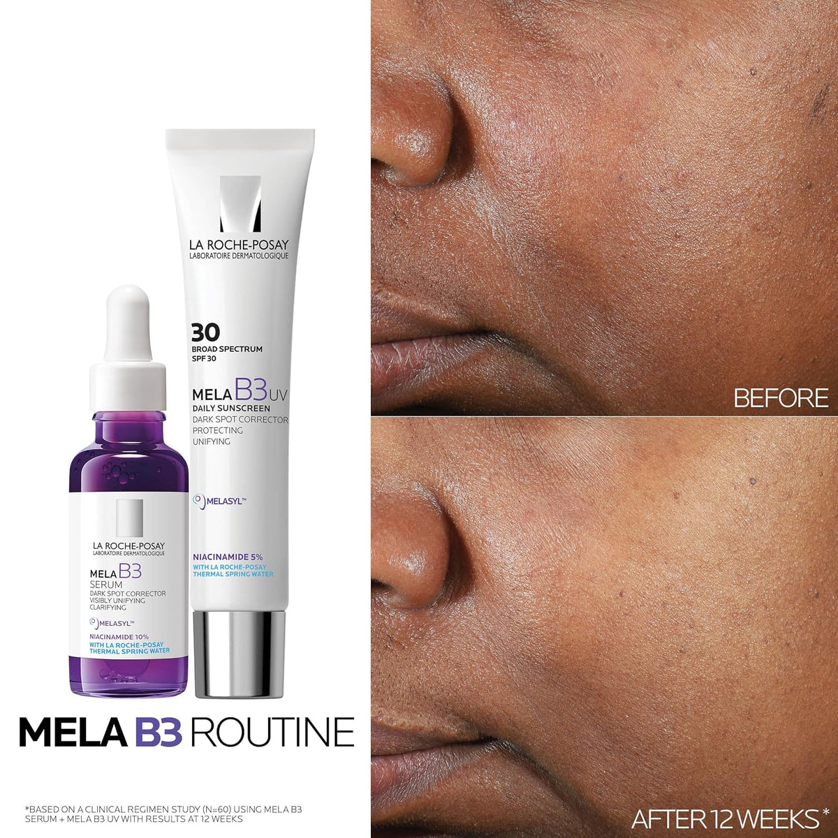 La Roche-Posay Mela B3 Dark Spot Serum, 1 fl oz (30 ml) - view 6