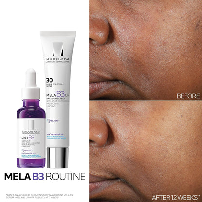 La Roche-Posay Mela B3 Dark Spot Serum, 1 fl oz (30 ml) - view 6